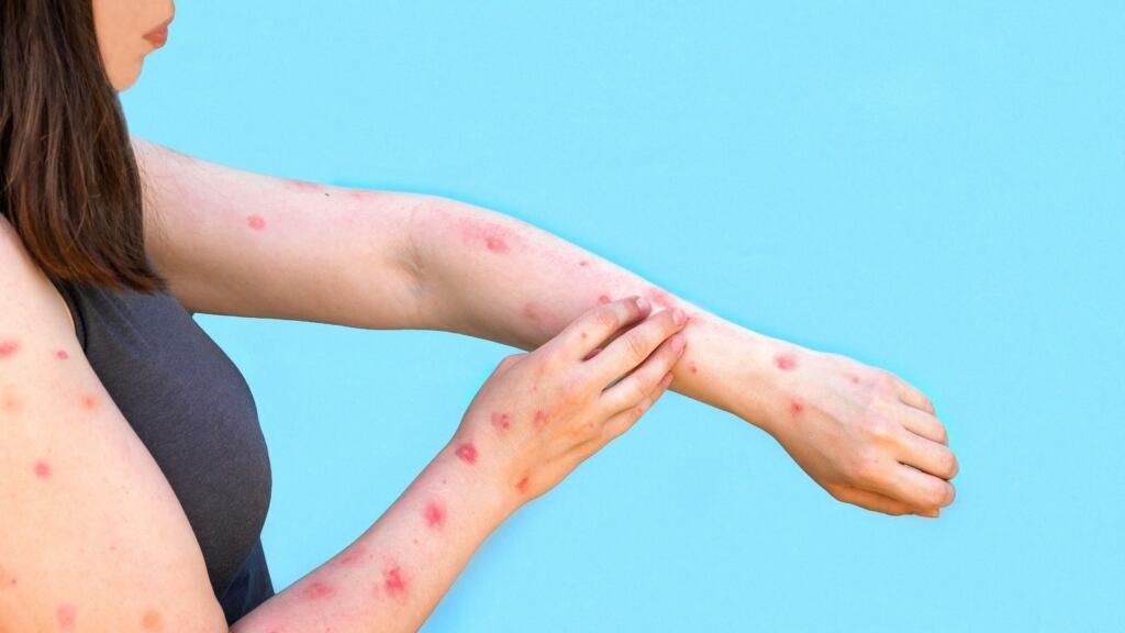 do-you-have-these-red-spots-on-various-parts-of-your-body-what-should